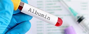 Albumin Niệu Là Gì